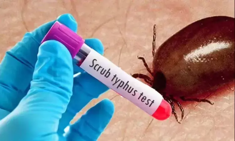 Andrapradesh, scrub typhus victims, Health Department