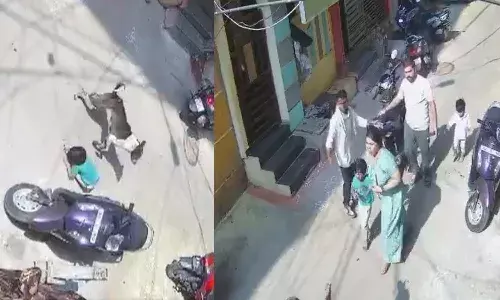 Hyderabad News, Khairatabad, Dog Attack On Child, Ghmc