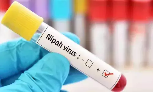 మ‌రోమారు నిఫా వైరస్ కలకలం.. విమానాశ్రయాల్లో హై అలర్ట్‌..!