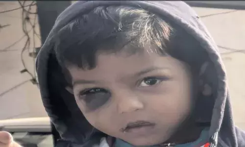 Telangana, Rajanna Siricilla District, Venkatapur, Anganwadi Teacher Assaults Boy