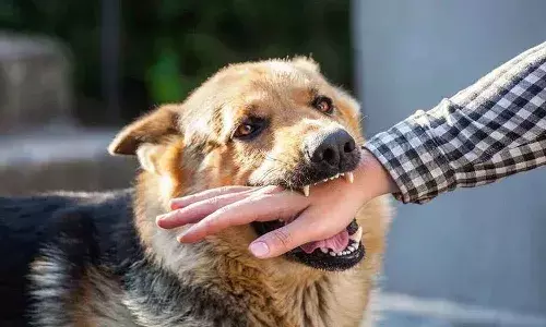 Dog bite treatment, Rabies prevention, Dog bite first aid, Anti-rabies vaccine