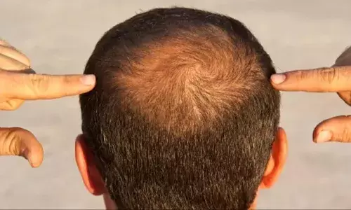 PP405 Hair Treatment, Male Pattern Baldness Cure, Pelage Pharmaceuticals, Hair Follicle Stem Cells, New Hair Regrowth Molecule, FDA Approval 2027, UCLA Hair Loss Research