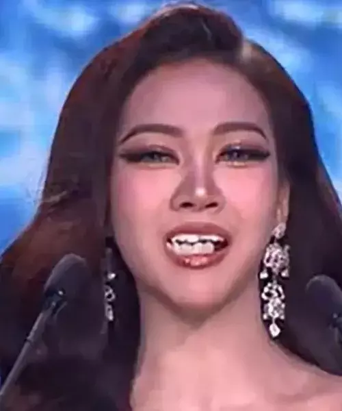 బ్యూటీ కాంటెస్ట్లో ఊడిన పెట్టుడు పళ్లు.. ఆమెకే ప్రశంసలు..! బ్యూటీ కాంటెస్ట్లో ఊడిన పెట్టుడు పళ్లు.. ఆమెకే ప్రశంసలు..!