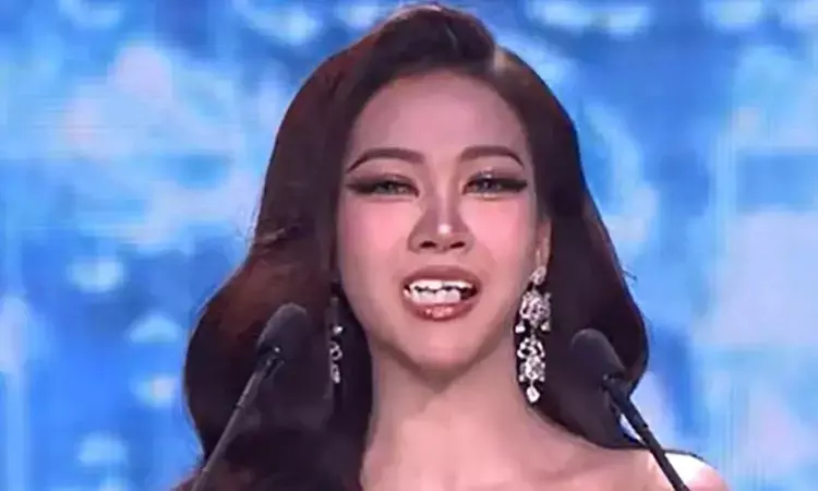 బ్యూటీ కాంటెస్ట్లో ఊడిన పెట్టుడు పళ్లు.. ఆమెకే ప్రశంసలు..! బ్యూటీ కాంటెస్ట్లో ఊడిన పెట్టుడు పళ్లు.. ఆమెకే ప్రశంసలు..!